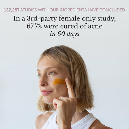 The Complete Acne System for Women