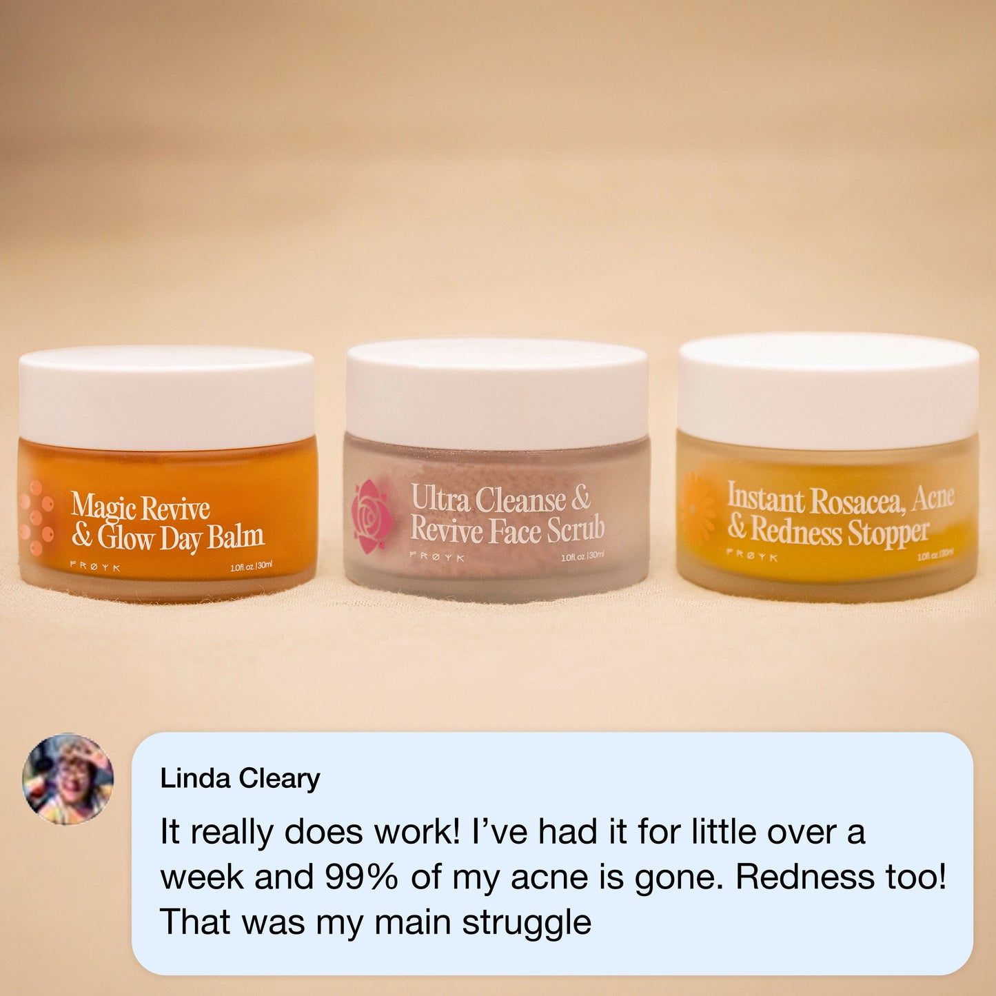 The Complete Acne System for Women