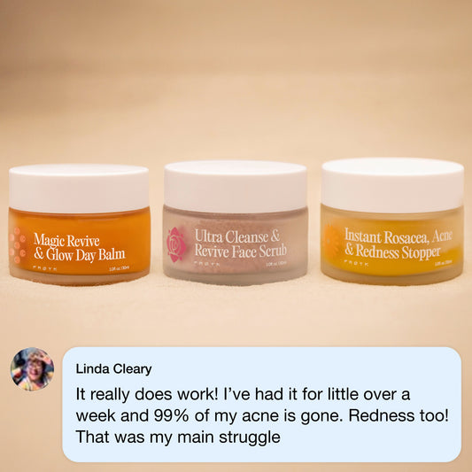 The Complete Acne System for Women